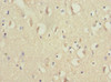Immunohistochemistry of paraffin-embedded human brain tissue using CSB-PA015668ESR2HU at dilution of 1:100