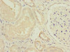 Immunohistochemistry of paraffin-embedded human kidney tissue using CSB-PA015668ESR2HU at dilution of 1:100