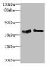 Western blot<br />
 All lanes: PHF11 antibody at 4.36µg/ml<br />
 Lane 1: Jurkat whole cell lysate<br />
 Lane 2: Hela whole cell lysate<br />
 Secondary<br />
 Goat polyclonal to rabbit IgG at 1/10000 dilution<br />
 Predicted band size: 38, 34 kDa<br />
 Observed band size: 38 kDa<br />