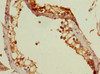 Immunohistochemistry of paraffin-embedded human testis tissue using CSB-PA850326ESR2HU at dilution of 1:100 Immunohistochemistry of paraffin-embedded human testis tissue using CSB-PA850326ESR2HU at dilution of 1:100
