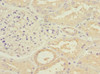 Immunohistochemistry of paraffin-embedded human kidney tissue using CSB-PA850326ESR2HU at dilution of 1:100