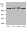 Western blot<br />
 All lanes: RPN2 antibody at 1.91µg/ml<br />
 Lane 1: NIH/3T3 whole cell lysate<br />
 Lane 2: 293T whole cell lysate<br />
 Lane 3: Hela whole cell lysate<br />
 Lane 4: Human placenta tissue<br />
 Secondary<br />
 Goat polyclonal to rabbit IgG at 1/10000 dilution<br />
 Predicted band size: 70, 68 kDa<br />
 Observed band size: 70 kDa<br />