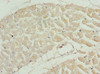 Immunohistochemistry of paraffin-embedded human heart tissue using CSB-PA024012ESR2HU at dilution of 1:100