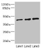 Western blot<br />
 All lanes: ZNF24 antibody at 2.88µg/ml<br />
 Lane 1: 293T whole cell lysate<br />
 Lane 2: Jurkat whole cell lysate<br />
 Lane 3: Hela whole cell lysate<br />
 Secondary<br />
 Goat polyclonal to rabbit IgG at 1/10000 dilution<br />
 Predicted band size: 43, 23 kDa<br />
 Observed band size: 43 kDa<br />