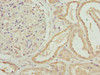 Immunohistochemistry of paraffin-embedded human kidney tissue using CSB-PA026606ESR2HU at dilution of 1:100