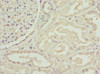 Immunohistochemistry of paraffin-embedded human kidney tissue using CSB-PA003490ESR1HU at dilution of 1:100