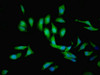 Immunofluorescent analysis of Hela cells using CSB-PA003490ESR1HU at dilution of 1:100 and Alexa Fluor 488-congugated AffiniPure Goat Anti-Rabbit IgG (H+L)