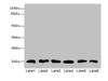 Western blot<br />
 All lanes: CFL2 antibody at 3.75µg/ml<br />
 Lane 1: Mouse brain tissue<br />
 Lane 2: Mouse liver tissue<br />
 Lane 3: Mouse lung tissue<br />
 Lane 4: LO2 whole cell lysate<br />
 Lane 5: Hela whole cell lysate<br />
 Lane 6: A549 whole cell lysate<br />
 Secondary<br />
 Goat polyclonal to rabbit IgG at 1/10000 dilution<br />
 Predicted band size: 19, 17 kDa<br />
 Observed band size: 19 kDa<br />