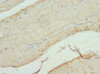 Immunohistochemistry of paraffin-embedded human skeletal muscle tissue using CSB-PA005281ESR1HU at dilution of 1:100