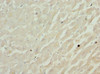 Immunohistochemistry of paraffin-embedded human heart tissue using CSB-PA005281ESR1HU at dilution of 1:100