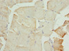 Immunohistochemistry of paraffin-embedded human skeletal muscle tissue using CSB-PA005281ESR2HU at dilution of 1:100