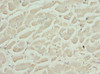 Immunohistochemistry of paraffin-embedded human heart tissue using CSB-PA005281ESR2HU at dilution of 1:100