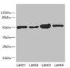 Western blot<br />
 All lanes: CHN1 antibody at 6.08µg/ml<br />
 Lane 1: 293T whole cell lysate<br />
 Lane 2: MCF-7 whole cell lysate<br />
 Lane 3: Jurkat whole cell lysate<br />
 Lane 4: Hela whole cell lysate<br />
 Secondary<br />
 Goat polyclonal to rabbit IgG at 1/10000 dilution<br />
 Predicted band size: 54, 39, 51 kDa<br />
 Observed band size: 51 kDa<br />