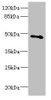 Western blot<br />
 All lanes: COX10 antibody at 5.31µg/ml + Mouse gonadal tissue<br />
 Secondary<br />
 Goat polyclonal to rabbit IgG at 1/10000 dilution<br />
 Predicted band size: 49, 28 kDa<br />
 Observed band size: 49 kDa<br />