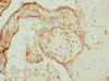 Immunohistochemistry of paraffin-embedded human placenta tissue using CSB-PA621520ESR1HU at dilution of 1:100