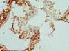 Immunohistochemistry of paraffin-embedded human testis tissue using CSB-PA528588ESR1HU at dilution of 1:100