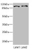 Western blot<br />
 All lanes: CCP110 antibody at 4.6µg/ml<br />
 Lane 1: Hela whole cell lysate<br />
 Lane 2: 293T whole cell lysate<br />
 Secondary<br />
 Goat polyclonal to rabbit IgG at 1/10000 dilution<br />
 Predicted band size: 114, 112 kDa<br />
 Observed band size: 114 kDa<br />