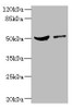 Western blot<br />
 All lanes: CPN1 antibody at 6.19µg/ml<br />
 Lane 1: Mouse liver tissue<br />
 Lane 2: MCF-7 whole cell lysate<br />
 Secondary<br />
 Goat polyclonal to rabbit IgG at 1/10000 dilution<br />
 Predicted band size: 52 kDa<br />
 Observed band size: 52 kDa<br />