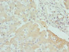 Immunohistochemistry of paraffin-embedded human liver tissue using CSB-PA005898ESR2HU at dilution of 1:100