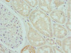 Immunohistochemistry of paraffin-embedded human kidney tissue using CSB-PA005898ESR2HU at dilution of 1:100