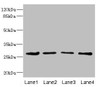 Western blot<br />
 All lanes: DCXR antibody at 2.93µg/ml<br />
 Lane 1: Mouse gonadal tissue<br />
 Lane 2: HepG2 whole cell lysate<br />
 Lane 3: A431 whole cell lysate<br />
 Lane 4: MCF-7 whole cell lysate<br />
 Secondary<br />
 Goat polyclonal to rabbit IgG at 1/10000 dilution<br />
 Predicted band size: 26 kDa<br />
 Observed band size: 26 kDa<br />