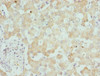 Immunohistochemistry of paraffin-embedded human liver tissue using CSB-PA772022ESR1HU at dilution of 1:100