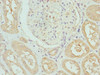 Immunohistochemistry of paraffin-embedded human kidney tissue using CSB-PA772022ESR1HU at dilution of 1:100