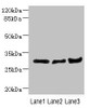 Western blot<br />
 All lanes: DCXR antibody at 2.23µg/ml<br />
 Lane 1: Mouse lung tissue<br />
 Lane 2: Mouse liver tissue<br />
 Lane 3: Mouse gonadal tissue<br />
 Secondary<br />
 Goat polyclonal to rabbit IgG at 1/10000 dilution<br />
 Predicted band size: 26 kDa<br />
 Observed band size: 26 kDa<br />