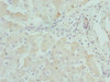 Immunohistochemistry of paraffin-embedded human liver tissue using CSB-PA772022ESR2HU at dilution of 1:100