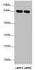 Western blot<br />
 All lanes: NDUFS1 antibody at 2.41 µg/ml<br />
 Lane 1: Mouse heart tissue<br />
 Lane 2: Mouse kidney tissue<br />
 Secondary<br />
 Goat polyclonal to rabbit IgG at 1/10000 dilution<br />
 Predicted band size: 80, 81, 68, 74, 76 kDa<br />
 Observed band size: 80 kDa<br />