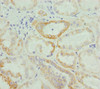 Immunohistochemistry of paraffin-embedded human kidney tissue using CSB-PA880931ESR2HU at dilution of 1:100