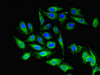 Immunofluorescent analysis of Hela cells using CSB-PA621865DSR1HU at dilution of 1:100 and Alexa Fluor 488-congugated AffiniPure Goat Anti-Rabbit IgG (H+L)