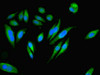 Immunofluorescent analysis of Hela cells using CSB-PA621865DSR2HU at dilution of 1:100 and Alexa Fluor 488-congugated AffiniPure Goat Anti-Rabbit IgG (H+L)