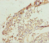 Immunohistochemistry of paraffin-embedded human testis tissue using CSB-PA012817ESR1HU at dilution of 1:100