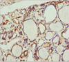 Immunohistochemistry of paraffin-embedded human thyroid tissue using CSB-PA856936ESR1HU at dilution of 1:100