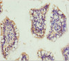 Immunohistochemistry of paraffin-embedded human small intestine tissue using CSB-PA009587ESR2HU at dilution of 1:100