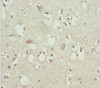 Immunohistochemistry of paraffin-embedded human brain tissue using CSB-PA859511ESR1HU at dilution of 1:100