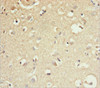 Immunohistochemistry of paraffin-embedded human brain tissue using CSB-PA859511ESR2HU at dilution of 1:100