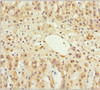 Immunohistochemistry of paraffin-embedded human adrenal gland tissue using CSB-PA859511ESR2HU at dilution of 1:100