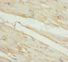 Immunohistochemistry of paraffin-embedded human skeletal muscle tissue using CSB-PA822745ESR1HU at dilution of 1:100