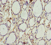 Immunohistochemistry of paraffin-embedded human thyroid tissue using CSB-PA001508DSR1HU at dilution of 1:100