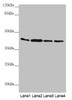 Western blot<br />
 All lanes: AKR7A2 antibody at 0.88µg/ml<br />
 Lane 1: Mouse small intestine tissue<br />
 Lane 2: Mouse liver tissue<br />
 Lane 3: Mouse gonadal tissue<br />
 Lane 4: A431 whole cell lysate<br />
 Secondary<br />
 Goat polyclonal to rabbit IgG at 1/10000 dilution<br />
 Predicted band size: 40 kDa<br />
 Observed band size: 40 kDa<br />