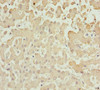 Immunohistochemistry of paraffin-embedded human liver tissue using CSB-PA001550ESR1HU at dilution of 1:100