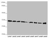 Western blot<br />
 All lanes: HADH antibody at 2.38µg/ml<br />
 Lane 1: Mouse heart tissue<br />
 Lane 2: Mouse liver tissue<br />
 Lane 3: Mouse kidney tissue<br />
 Lane 4: Mouse skeletal muscle tissue<br />
 Lane 5: NIH/3T3 whole cell lysate<br />
 Lane 6: Hela whole cell lysate<br />
 Lane 7: 293T whole cell lysate<br />
 Lane 8: A431 whole cell lysate<br />
 Lane 9: Jurkat whole cell lysate<br />
 Secondary<br />
 Goat polyclonal to rabbit IgG at 1/10000 dilution<br />
 Predicted band size: 35, 43, 37 kDa<br />
 Observed band size: 35 kDa<br />