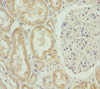Immunohistochemistry of paraffin-embedded human kidney tissue using CSB-PA614992ESR1HU at dilution of 1:100