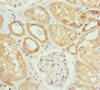 Immunohistochemistry of paraffin-embedded human kidney tissue using CSB-PA614992ESR2HU at dilution of 1:100