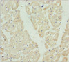 Immunohistochemistry of paraffin-embedded human heart tissue using CSB-PA614992ESR2HU at dilution of 1:100