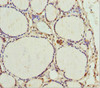 Immunohistochemistry of paraffin-embedded human thyroid tissue using CSB-PA619078ESR1HU at dilution of 1:100