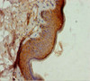 Immunohistochemistry of paraffin-embedded human skin tissue using CSB-PA619078ESR1HU at dilution of 1:100