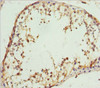 Immunohistochemistry of paraffin-embedded human testis tissue using CSB-PA884432DSR2HU at dilution of 1:100